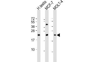 All lanes : Anti-STAG3L1 Antibody (Center) at 1:2000 dilution Lane 1: human testis lysate Lane 2: MCF-7 whole cell lysate Lane 3: MOLT-4 whole cell lysate Lysates/proteins at 20 μg per lane. (STAG3L1 antibody  (AA 108-136))