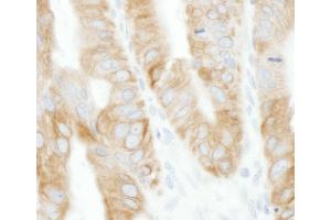 Immunohistochemistry (IHC) image for anti-TNF Receptor-Associated Factor 2 (TRAF2) (AA 300-350) antibody (ABIN7453559)