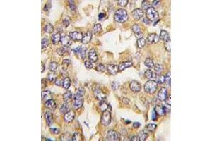 Image no. 3 for anti-Visinin-Like 1 (VSNL1) (C-Term) antibody (ABIN357108) (VSNL1 antibody  (C-Term))