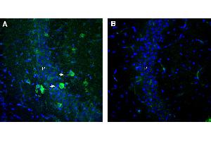 Free-floating frozen brain sections from a paraformaldehyde-perfused mouse were incubated with Anti-GPR151 (extracellular) antibody (ABIN7884968, 1:300), followed by goat anti-rabbit secondary antibody conjugated to Alexa Fluor® 488 (green).