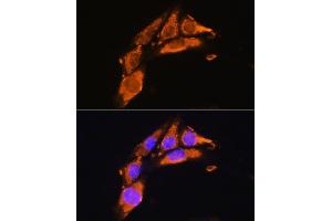 Immunofluorescence analysis of NIH/3T3 cells using AGRN Rabbit pAb (ABIN7265516) at dilution of 1:100. (AGRN antibody  (AA 30-350))