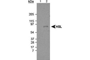 Western blot analysis of Lipe using Lipe polyclonal antibody . (LIPE antibody  (AA 699-908))