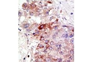 Image no. 2 for anti-Protein Inhibitor of Activated STAT, 1 (PIAS1) (N-Term) antibody (ABIN5552003) (PIAS1 antibody  (N-Term))