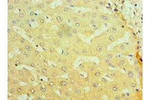 Immunohistochemistry of paraffin-embedded human liver tissue using ABIN7161897 at dilution of 1:100 (NR1I2 antibody  (AA 175-434))