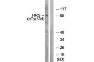 Western blot analysis of extracts from HepG2 cells treated with PMA 125ng/ml 30', using HRS (Phospho-Tyr334) Antibody. (HRS (HRS) (AA 301-350), (pTyr334) antibody)