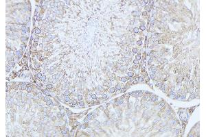 ABIN6279533 at 1/100 staining Mouse testis tissue by IHC-P.