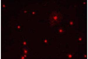 Immunostaining of primary rat oligodendrocytes using anti-Olig1. (OLIG1 antibody)