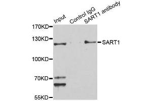 Immunoprecipitation analysis of 150 μg extracts of Jurkat cells using 3 μg SART1 antibody (ABIN5996293). (SART1 antibody)