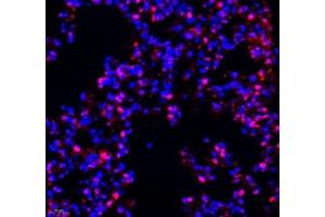 Immunofluorescence of paraffin embedded mouse lung using Transketolase (ABIN7075978) at dilution of 1: 1100 (400x lens) (TKT antibody)