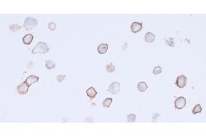 Immunocytochemistry (ICC) image for anti-Platelet Derived Growth Factor Receptor alpha (PDGFRA) (AA 24-525) antibody (ABIN7453341) (Recombinant PDGFRA antibody  (AA 24-525))