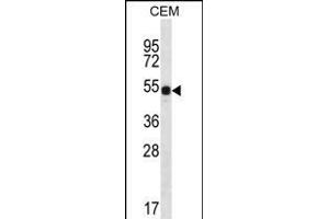 DAZ3 Antibody (C-term) (ABIN656239 and ABIN2845555) western blot analysis in CEM cell line lysates (35 μg/lane).