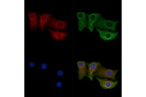 ABIN7094674 and ABIN7098725 staining Hela cells by IF/ICC. (CPEB4 antibody  (Internal Region))