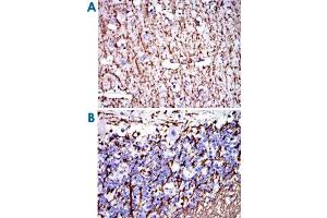 Immunohistochemical analysis of paraffin-embedded human brain (A) and human cerebellum (B) tissues using MBP monoclonal antibody, clone 2H9  with DAB staining.