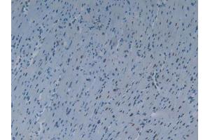 IHC-P analysis of Mouse Heart Tissue, with DAB staining. (KHDRBS1 antibody  (AA 156-381))