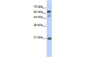 Western Blotting (WB) image for anti-Germinal Center Expressed Transcript 2 (GCET2) antibody (ABIN2459927)