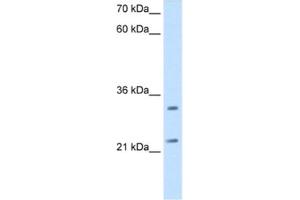 Western Blotting (WB) image for anti-Chromosome 21 Open Reading Frame 33 (C21orf33) antibody (ABIN2462904) (C21orf33 antibody)