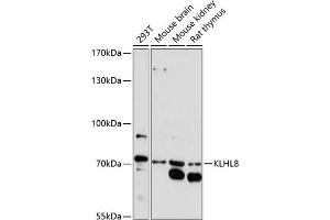 Western blot analysis of extracts of various cell lines, using KLHL8 antibody (ABIN7268081) at 1:1000 dilution. (KLHL8 antibody  (AA 271-620))