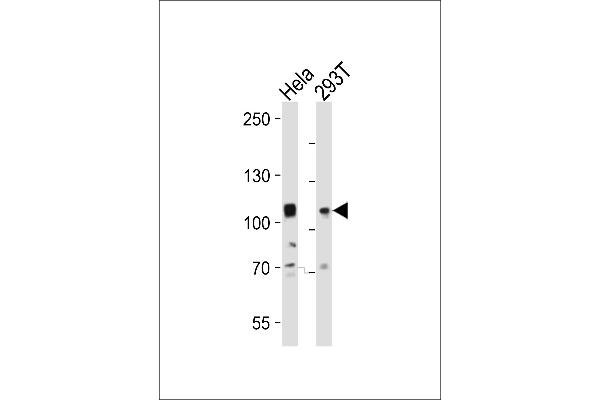 EPH Receptor A10 antibody  (N-Term)