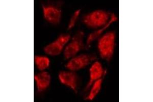 ABIN6267240 staining K562 by IF/ICC. (JAK2 antibody  (pTyr221))