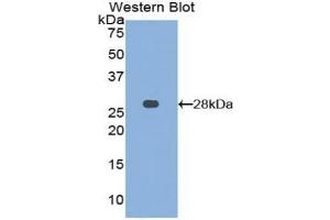 Western blot analysis of the recombinant protein. (MMP15 antibody  (AA 336-539))