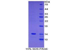 SDS-PAGE (SDS) image for Complement Component 4 Binding Protein, alpha (C4BPA) (AA 358-469) protein (His tag) (ABIN1877933)