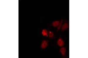 ABIN6275420 staining HepG2 by IF/ICC. (S100A5 antibody)