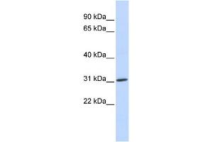 WB Suggested Anti-ARD1A Antibody Titration:  0.