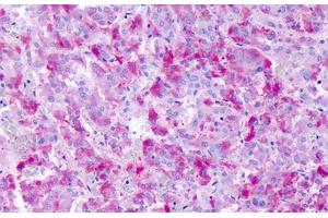 Anti-GPR139 antibody IHC staining of human adrenal medulla. (GPR139 antibody  (Cytoplasmic Domain))