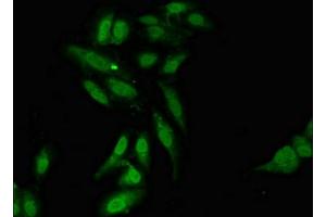 Immunofluorescent analysis of Hela cells using ABIN7158006 at dilution of 1:100 and Alexa Fluor 488-congugated AffiniPure Goat Anti-Rabbit IgG(H+L) (L3MBTL2 antibody  (AA 1-230))