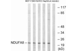 Western Blotting (WB) image for anti-NADH Dehydrogenase (Ubiquinone) 1 alpha Subcomplex, 8, 19kDa (NDUFA8) (Internal Region) antibody (ABIN1851636)