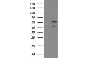HEK293T cells were transfected with the pCMV6-ENTRY control (Left lane) or pCMV6-ENTRY KATNAL1 (Right lane) cDNA for 48 hrs and lysed. (KATNAL1 antibody)