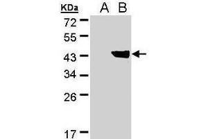 WB Image Western Blot analysis of DHDH expression in transfected 293T cell line by DHDH polyclonal antibody. (AKR1C1 antibody)