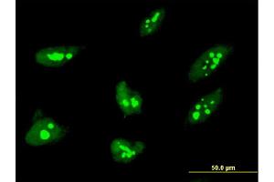 Immunofluorescence of monoclonal antibody to THAP1 on HeLa cell. (THAP1 antibody  (AA 1-213))