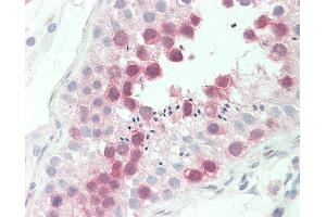 Anti-MPS1 / TTK antibody IHC staining of human testis. (Mps1 antibody  (AA 1-176))