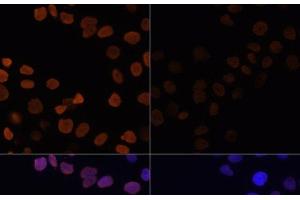 Immunofluorescence (IF) image for anti-Histone H2B (acLys12) antibody (ABIN7258518)
