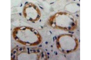 Used in DAB staining on fromalin fixed paraffin-embedded Kidney tissue (CD59 antibody  (AA 23-105))