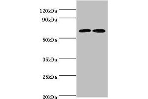 Western blot All lanes: CREB3L2 antibody at 6 μg/mL Lane 1: Mouse liver tissue Lane 2: Mouse lung tissue Secondary Goat polyclonal to rabbit IgG at 1/10000 dilution Predicted band size: 58, 51, 28 kDa Observed band size: 58 kDa (CREB3L2 antibody  (AA 1-247))