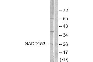 Western blot analysis of extracts from LOVO cells, treated with serum (10%, 15mins), using GADD153 antibody (#C0202). (DDIT3 antibody)