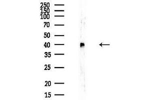 anti-Kruppel-Like Factor 7 (Ubiquitous) (KLF7) (Internal Region) antibody