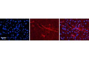 Rabbit Anti-SLC5A5 Antibody  Catalog Number: ARP43751_P050 Formalin Fixed Paraffin Embedded Tissue: Human Adult liver  Observed Staining: Membrane Primary Antibody Concentration: 1:600 Secondary Antibody: Donkey anti-Rabbit-Cy2/3 Secondary Antibody Concentration: 1:200 Magnification: 20X Exposure Time: 0.