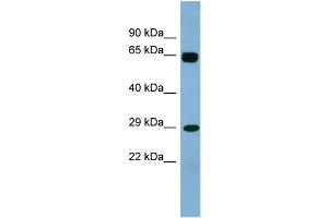 WB Suggested Anti-LRRN4CL Antibody Titration: 0. (LRRN4CL antibody  (Middle Region))