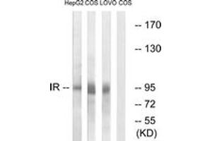 Western blot analysis of extracts from COS/HEPG2/LOVO cells, using IR (Ab-1361) Antibody. (IR (AA 1321-1370) antibody)