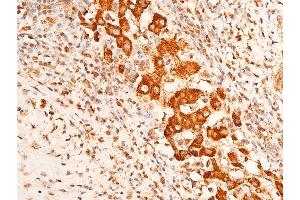 Immunohistochemistry (IHC) image for anti-Checkpoint Kinase 1 (CHEK1) (pSer296) antibody (ABIN6256251)