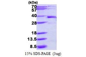 Deoxyribose-Phosphate Aldolase (DERA) (AA 1-318) protein (His tag)