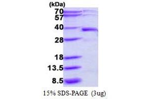 SDS-PAGE (SDS) image for Deoxyribose-Phosphate Aldolase (DERA) (AA 1-318) protein (His tag) (ABIN667544) (DERA Protein (AA 1-318) (His tag))