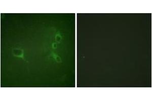 Immunofluorescence analysis of NIH-3T3 cells, using Bcr (Phospho-Tyr360) Antibody. (BCR antibody  (pTyr360))