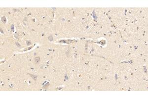 Detection of AHSG in Bovine Cerebellum Tissue using Polyclonal Antibody to Alpha-2-Heremans Schmid Glycoprotein (AHSG) (Fetuin A antibody  (AA 19-359))