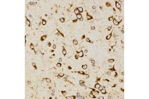 Immunohistochemistry of paraffin-embedded rat brain using LAMP3 antibody (ABIN5971497) at dilution of 1/200 (40x lens). (LAMP3 antibody)