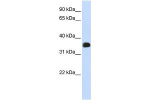 WB Suggested Anti-C2orf47 Antibody Titration:  0. (C2orf47 antibody  (Middle Region))