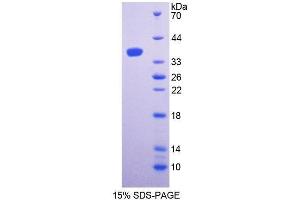 SDS-PAGE (SDS) image for CD24 Molecule (CD24) (AA 27-80) protein (His tag,GST tag) (ABIN1170073) (CD24 Protein (AA 27-80) (His tag,GST tag))